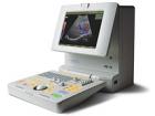 Sonoace Pico, Sonoace-Medison – портативный УЗИ сканер с цветным допплером и кардиопакетом