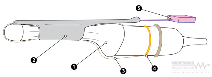 Схема использования набора для биопсии для внутриполостных ультразвуковых датчиков